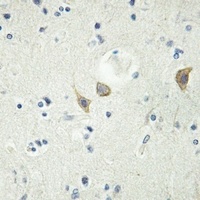 Anti-LTK Antibody