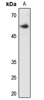 Clipin A Rabbit Polyclonal Antibody