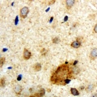 Clipin A Rabbit Polyclonal Antibody