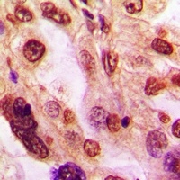 Anti-ZFP36L2 Antibody