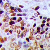 Anti-CBP20 Antibody