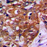 Anti-MVK Antibody