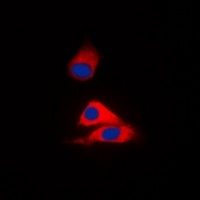 Anti-MVK Antibody