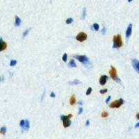 FOXE3 antibody