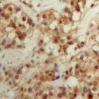 Anti-CBFB Antibody