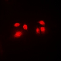 Anti-CBFB Antibody