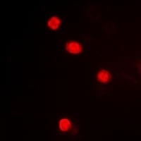 Anti-MAPKAPK3 Antibody