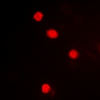 MAPKAPK3 antibody