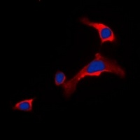 Anti-DOK6 Antibody