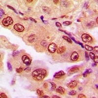 Anti-DPF2 Antibody