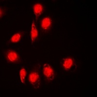 Anti-DPF2 Antibody