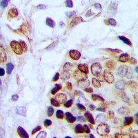 Anti-TAF15 Antibody