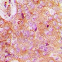 Anti-FAM84B Antibody