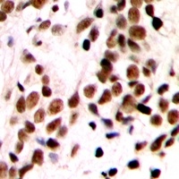 Anti-GTF2IRD1 Antibody