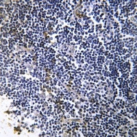 Anti-Collagen 19 alpha 1 Antibody