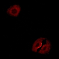 Anti-Collagen 19 alpha 1 Antibody