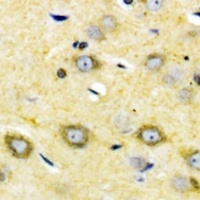 Anti-Cytochrome P450 2W1 Antibody