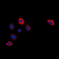 Anti-Cytochrome P450 2W1 Antibody