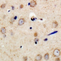 PSMD11 Antibody