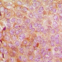 Anti-MRPL48 Antibody