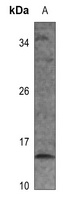 RPS12 Antibody