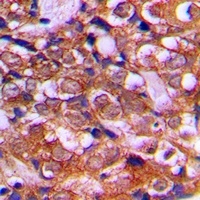 Anti-RPS12 Antibody
