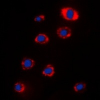 Anti-RPS12 Antibody