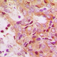 Anti-RPS13 Antibody