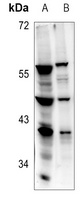 RPL5 Antibody