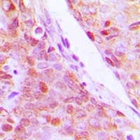 Anti-RPL5 Antibody
