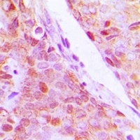 RPL5 antibody