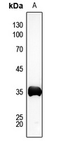AKR1C2 Antibody