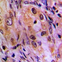 AKR1C2 Antibody