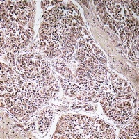 Anti-ATP5C1 Antibody