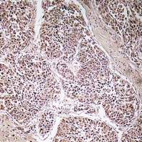 ATP5C1 antibody