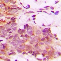 Anti-CNTROB Antibody