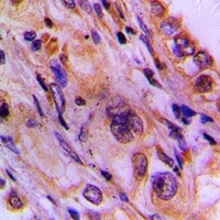 Anti-CEP78 Antibody