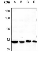 CstF-64T Rabbit Polyclonal Antibody