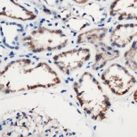 Anti-Complement C1S Antibody