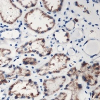 Anti-DMGDH Antibody