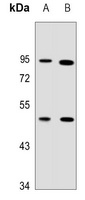 TUFM Rabbit Polyclonal Antibody