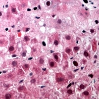 Anti-TUFM Antibody