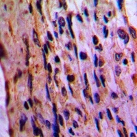 Anti-EIF3D Antibody