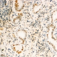 Anti-FUBP3 Antibody