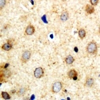 Anti-SAR1B Antibody