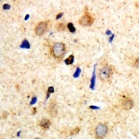 Myosin 14 Rabbit Polyclonal Antibody
