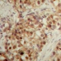 Anti-LONP2 Antibody