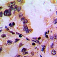 Anti-PABPC5 Antibody