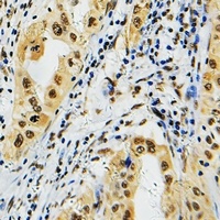 Anti-PRPF39 Antibody
