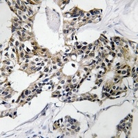 RSAD1 Antibody